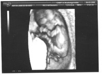 10 - 18 неделя беременности фото 5