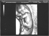 10 - 18 тиждень вагітності фото 6