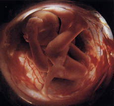 10 - 18 тиждень вагітності фото 14