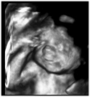 19 - 27 тиждень вагітності фото 4