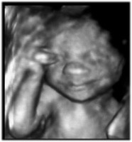 19 - 27 недель беременности фото 3