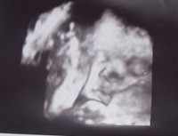 28 - 36 тиждень вагітності фото 1