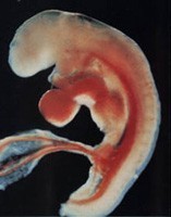 1 - 9 тиждень вагітності фото 6