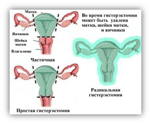 ЛАВГ