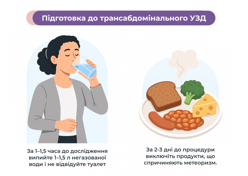 УЗД трансабдомінальне